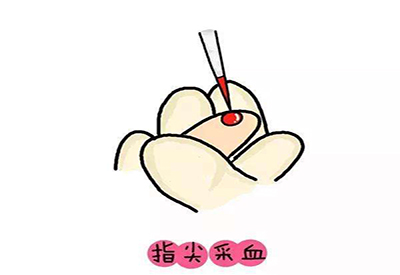 儿童正在播放麻豆微量元素的检测项目有哪些